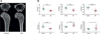 Fecal and Serum Metabolomic Signatures and Microbial Community Profiling of Postmenopausal Osteoporosis Mice Model